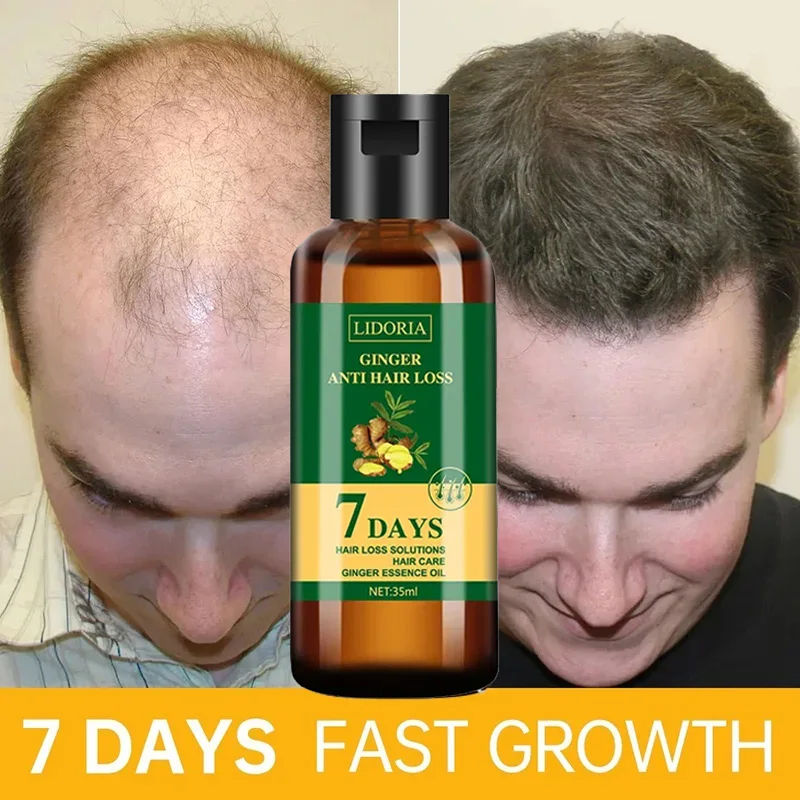 Hair Care Essential Oil Atomizing - Ginger Hair Growth Essential Oil Anti-loss