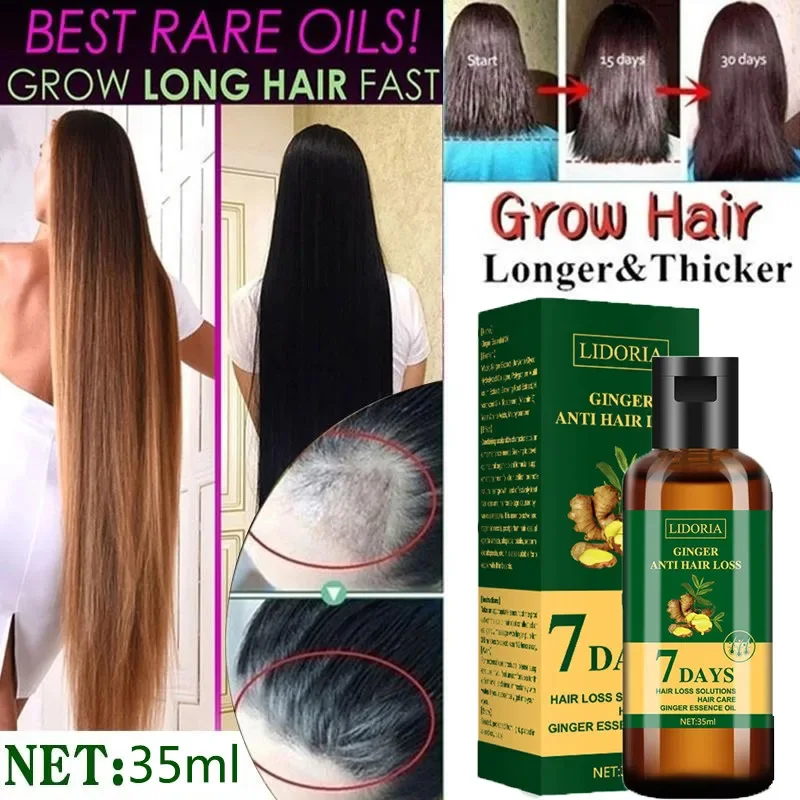 Ginger Hair Growth Essential O - Hair Care Essential Oil Atomizing recension och pris