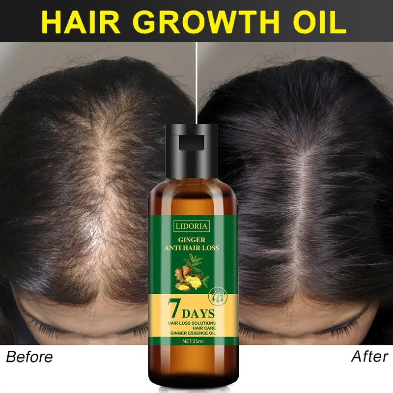 Ginger Hair Growth Essential O - Hair Care Essential Oil Atomizing recension och pris