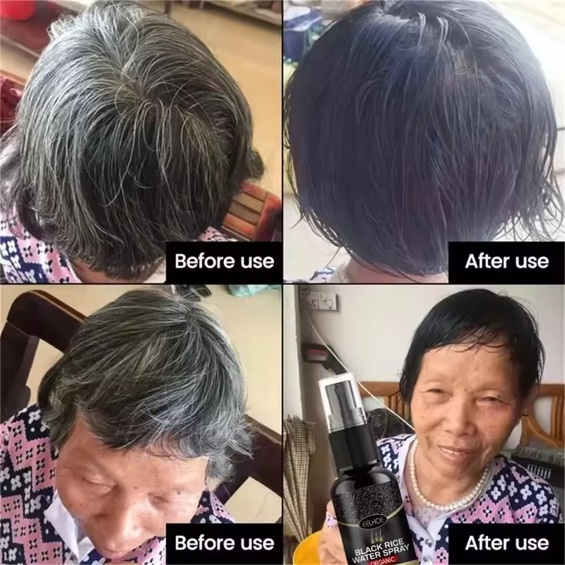 Gray White Hair Treatment Seru - Hair Care Ginseng recension och pris