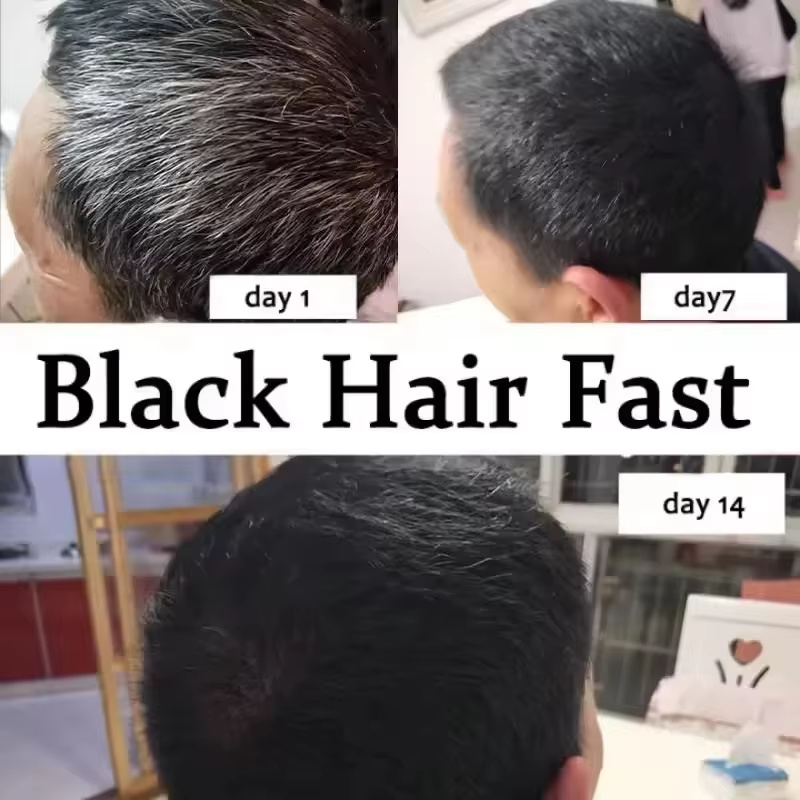 Gray White Hair Treatment Seru - Hair Care Ginseng recension och pris