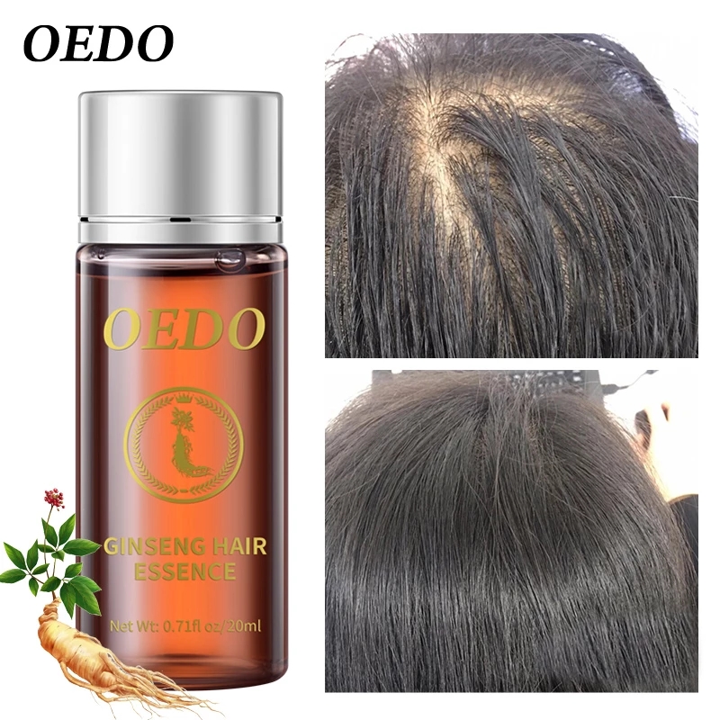 20ML Ginseng Hair Growth Essen - Hair Care Ginseng recension och pris