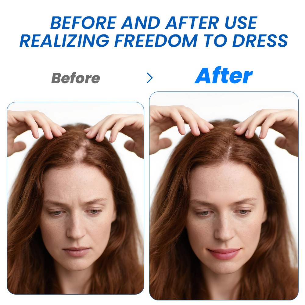 Alopecia Hair Growth Spray Sop - Hair Care Growth recension och pris