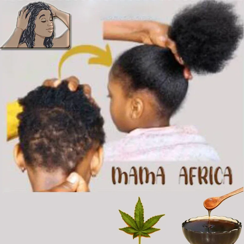 Africa Women Traction Alopecia - Hair Care Ginseng recension och pris